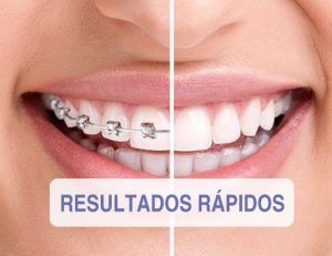 resultados