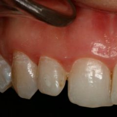 dientes-mas-largos dientes-mas-largos